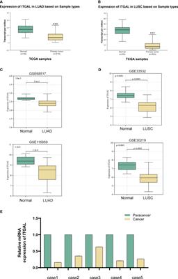 ITGAL expression in non-small-cell lung cancer tissue and its association with immune infiltrates